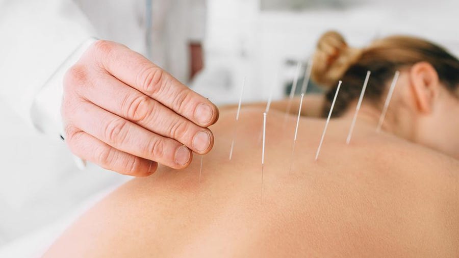 Acupuncture, Chiroaxion.com