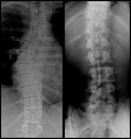 Radiologie, Chiroaxion.com